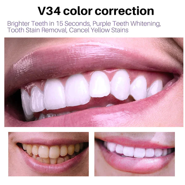 V34 مصل مصحح لون الأسنان